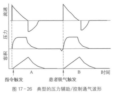 机械通气波形监测