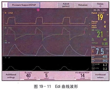 膈肌电信号监测