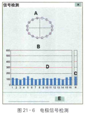电阻抗断层显像