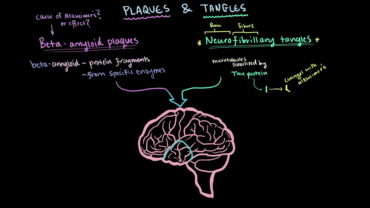 Dementia, delirium, and Alzheimer's-Mimosa